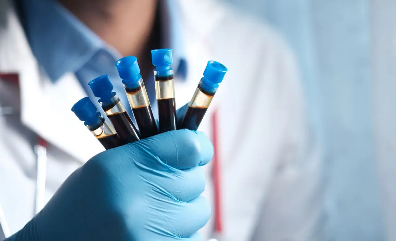 No te haces un chequeo general por miedo a los resultados: te contamos qué pruebas básicas incluyen